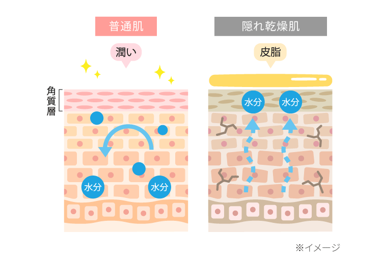 普通肌と隠れ乾燥肌