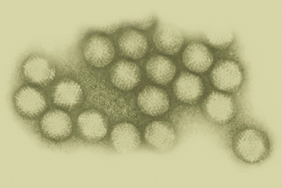 ノンエンベロープウイルスってなに?